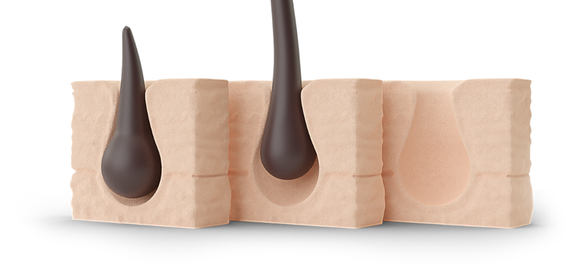 hair-3steps